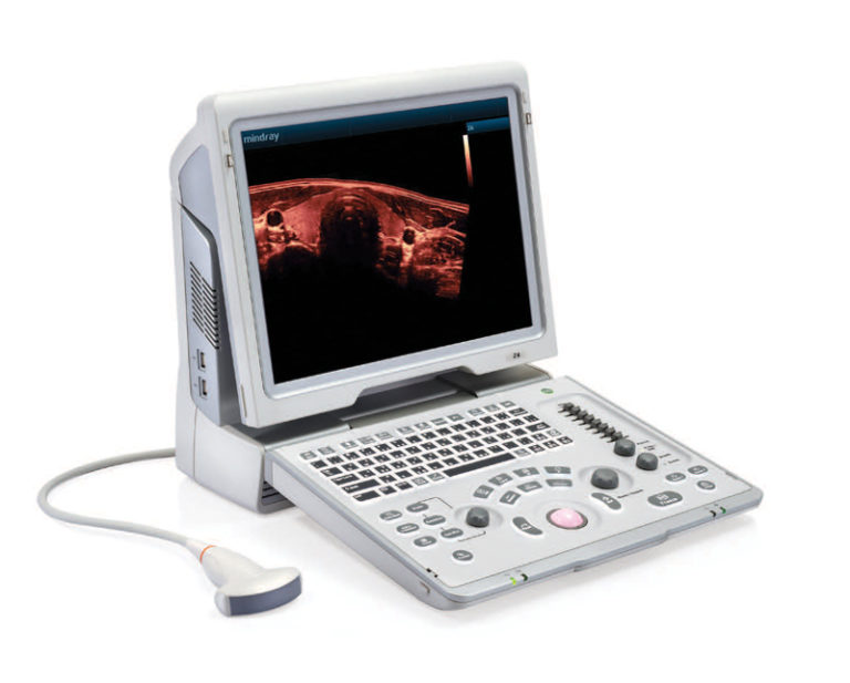 Digital Ultrasonic Diagnostic Imaging System W. Med Solutions