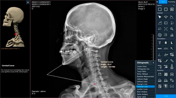 imagen-2